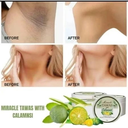 FreeShipping Philippines 10PACK Miracle Tawas Calamansi Cream Whitening antiperspirant cream