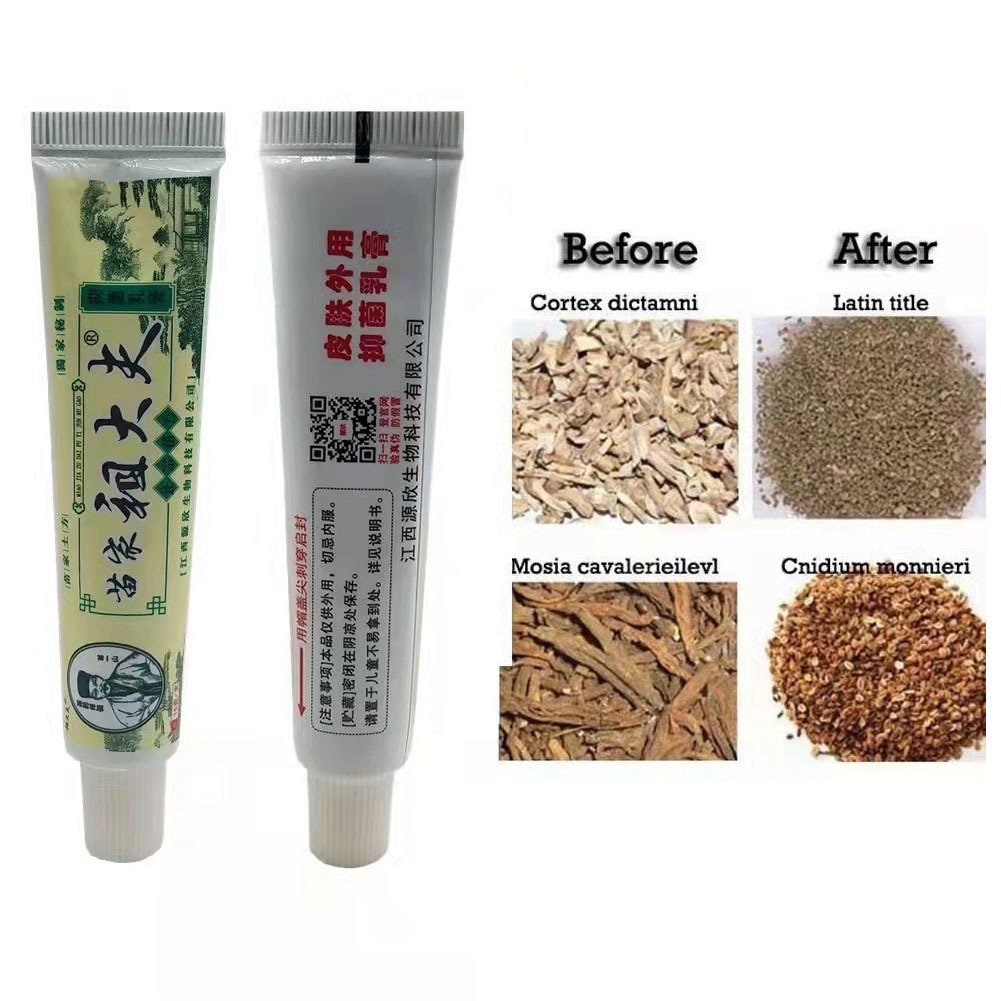 FreeShipping Buy 1 Take 4 (5 Pcs) MiaoJia Zudaifu Chinese Herbal Skin Cream Oingtment 15g*5