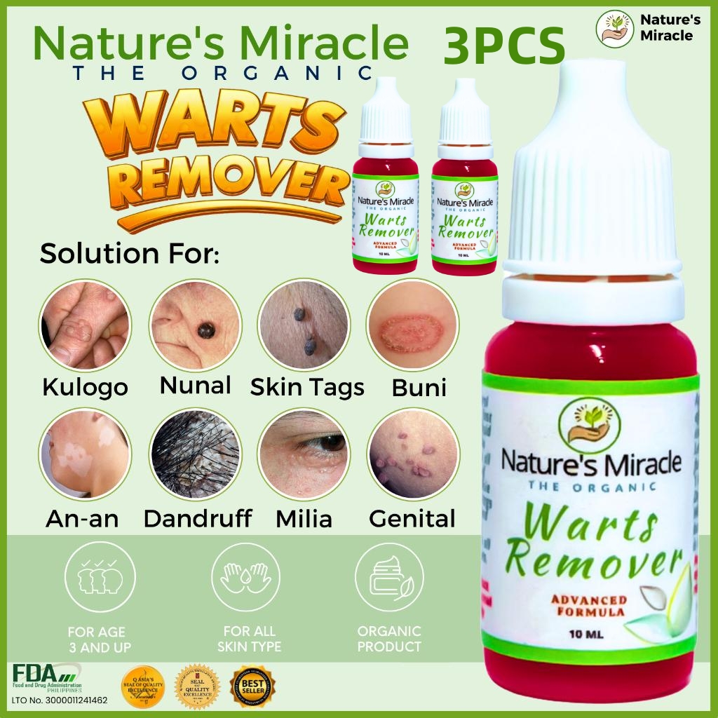 BUY 1 TAKE 2=3PCS Warts Remover Kasoy Oil Warts Remover Original Mole Remover Kulogo Buni Removal By Nature