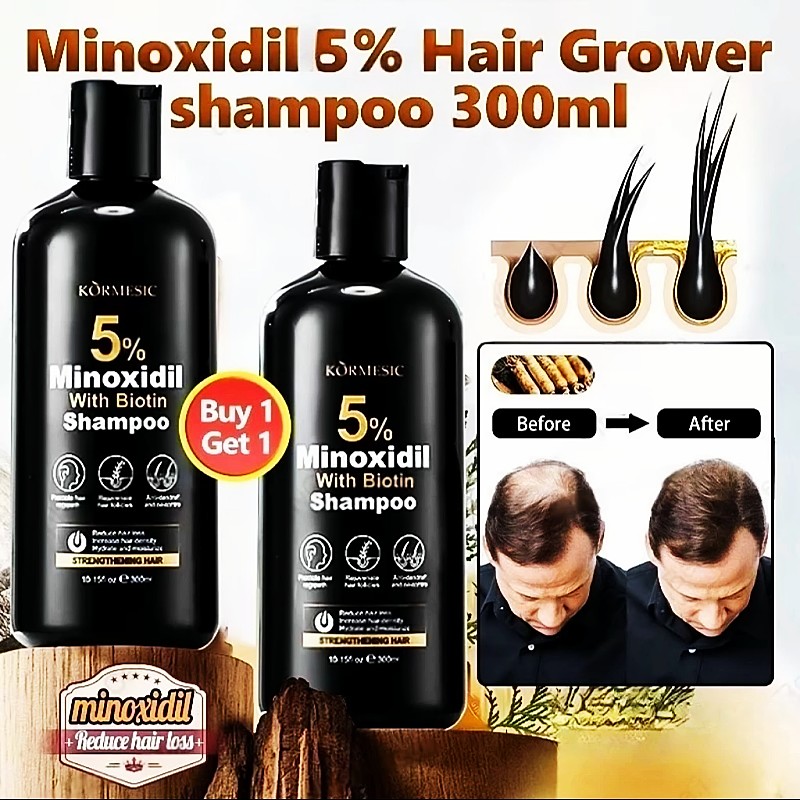 BUY 1 TAKE 1 Minoxidil 5% Shampoo With Biotin Treat Hair Loss and Strengthen Hair Roots 300ml